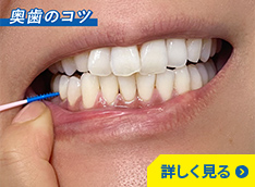 持ち手付きフロス（I字型）奥歯のコツ