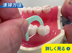 持ち手付きフロス（糸ようじ）の清掃方法