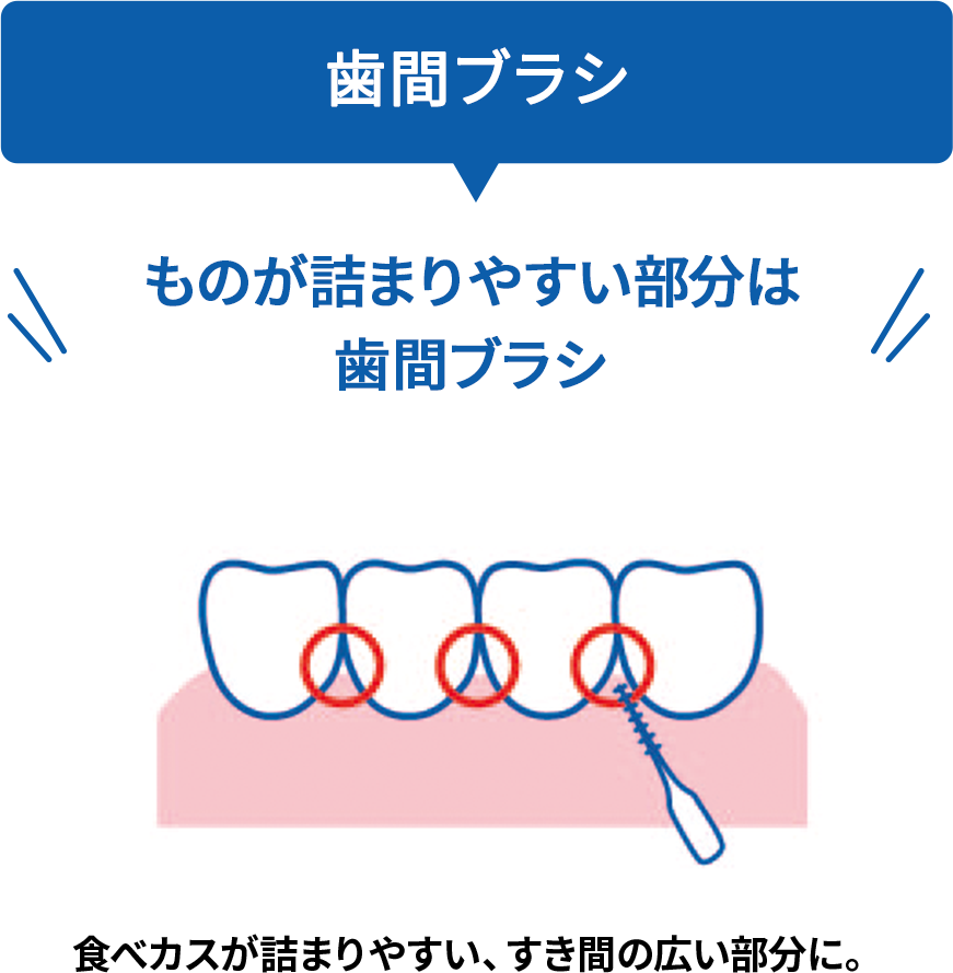 歯間ブラシ ものが詰まりやすい部分は歯間ブラシ 食べカスが詰まりやすい、すき間の広い部分に。