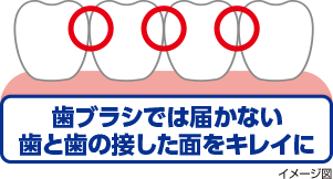 歯間に虫歯ができやすい…フロスが上手に使えない…