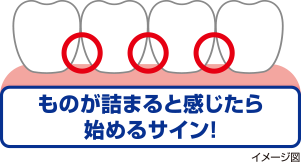 最近、歯間にモノが詰まりやすい…歯ぐきが下がってきた…