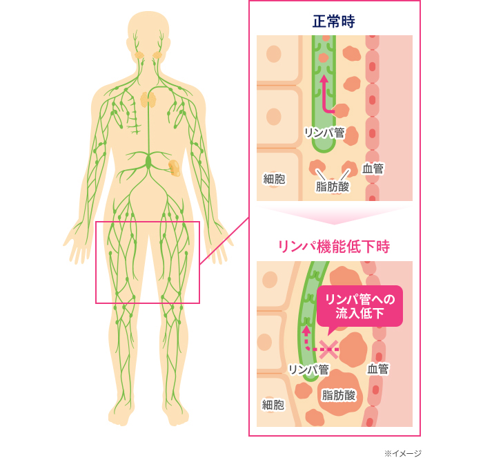 正常時 リンパ機能低下時