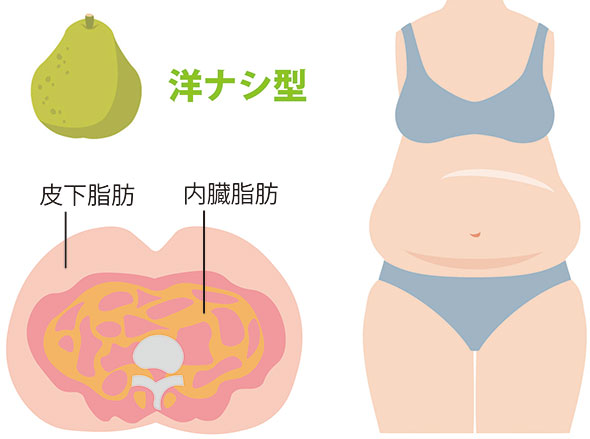 洋ナシ型 皮下脂肪 内臓脂肪