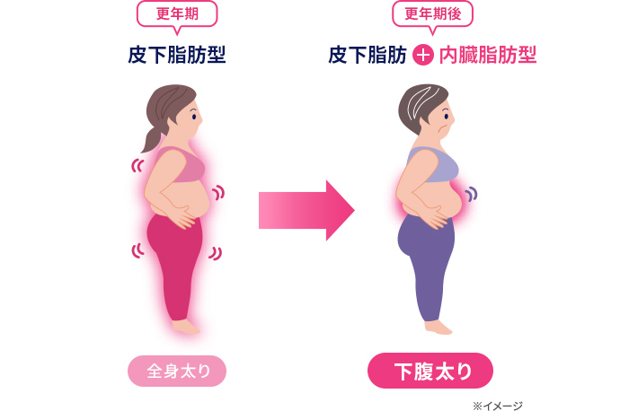 更年期：皮下脂肪型 全身太り 更年期後：皮下脂肪+内臓脂肪型 下腹部太り
