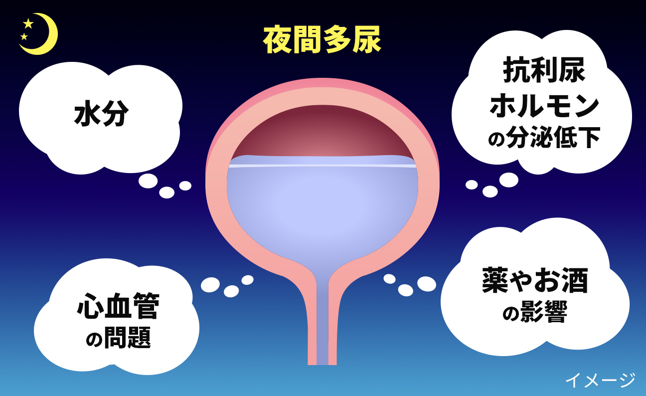 夜間多尿の原因：水分、抗利尿ホルモンの分泌低下、心血管の問題、薬やお酒の影響など