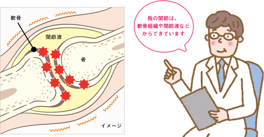 指の関節は、軟骨組織や関節液などからできています。