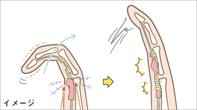 手指の病気について ユービケア 小林製薬