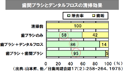 歯間ブラシとデンタルフロスの清掃効果