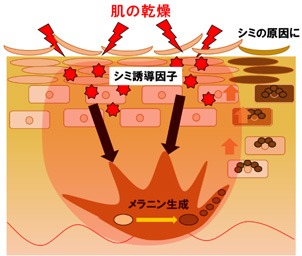 乾燥がしみの原因となるメカニズム