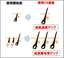 使用開始前 使用24週後 成長速度アップ 成長期毛率アップ
