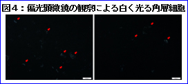 図4：偏光顕微鏡の観察による白く光る角層細胞