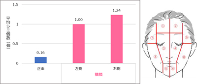 正面と横顔の大きな（直径6mm以上）シミの数