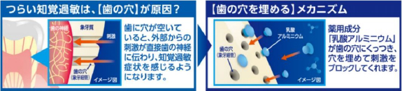 1.2つの有効成分でつらい知覚過敏症状をしっかりケア