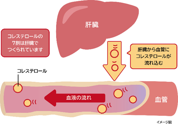 子供の高コレステロールはどのように治療されますか?