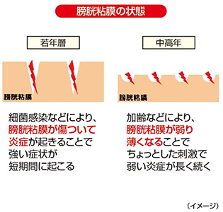 膀胱粘膜の状態