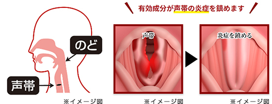 漢方処方“響声破笛丸”が声帯の炎症を抑えて「声がれ」を改善