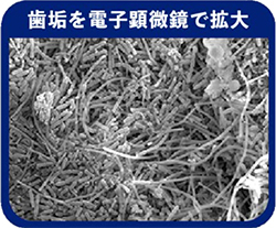 歯垢を電子顕微鏡で拡大