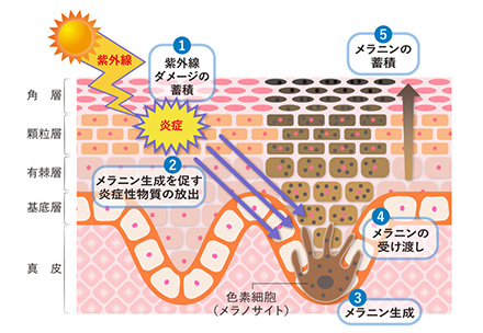 図2：シミができるメカニズム