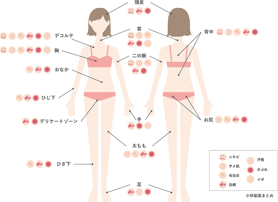 からだのブツブツまるわかりMAP