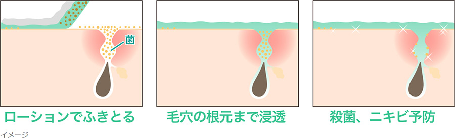 ニキビのできにくい肌の土台をつくる、独自のふきとりケア