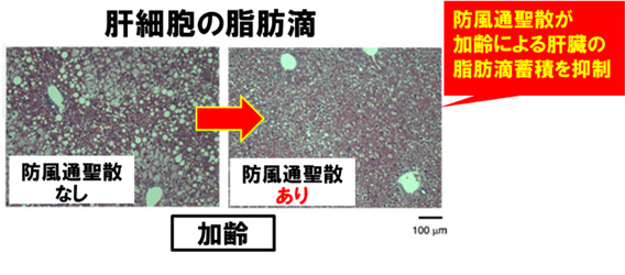 図2:肝臓の異所性脂肪蓄積の抑制
