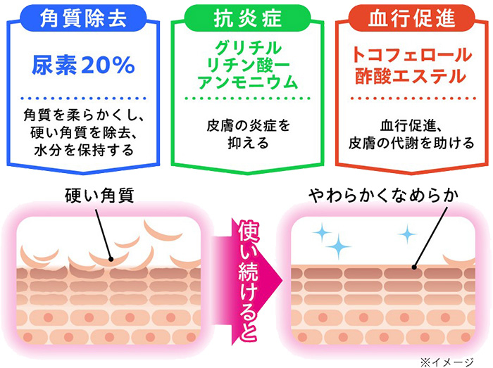 角質除去 抗炎症 血行促進
