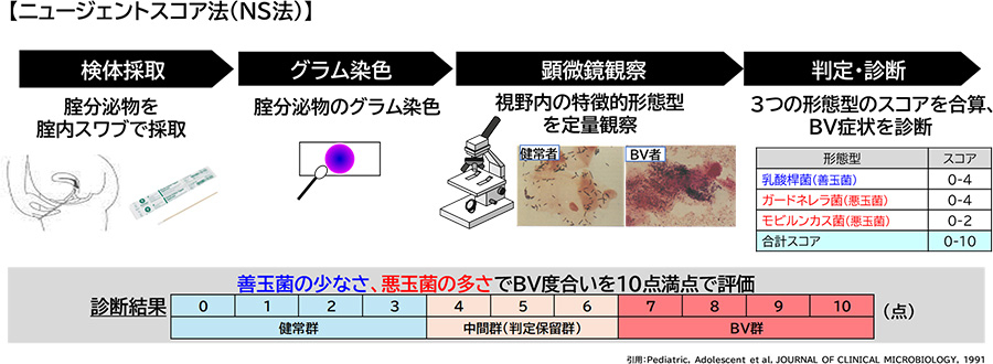 ニュージェントスコア法（NS法）