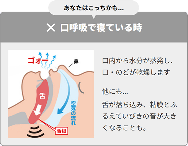 口呼吸で寝ている時