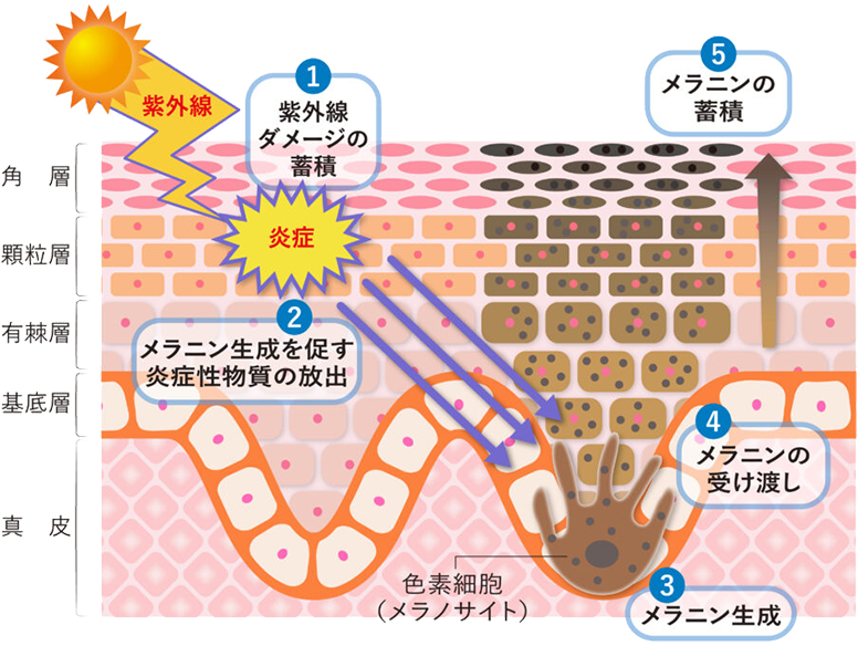 図１：シミができるメカニズム