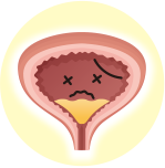 40代からの長引く症状は弱った膀胱粘膜が原因!?