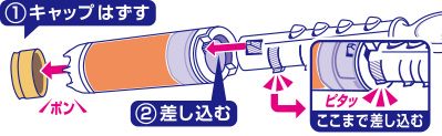 グリップ取り付け