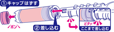 グリップ取り付け