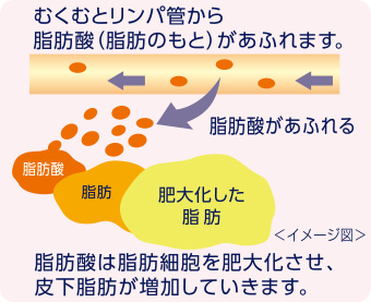 むくむとリンパ管から脂肪酸（脂肪のもと）があふれます。