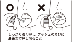（1）ノズル先端を舌に向けてポンプを3プッシュし、薬液を速やかに服用してください（薬液が直接のどに当たらないよう注意すること）