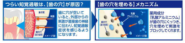 [薬用]ハウメルつらい知覚過敏ケア 歯がしみるのを防ぐ