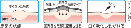 角質除去のしくみ
