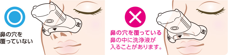 洗浄液を入れる前に、専用カップを鼻にあてて鼻呼吸できる位置を確認ください