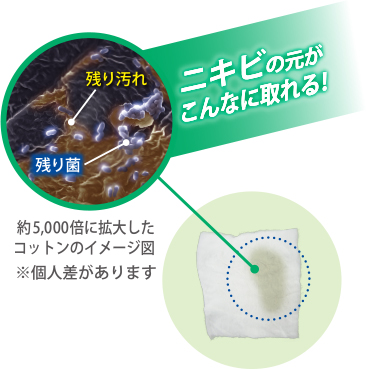 ニキビの元がこんなに取れる！