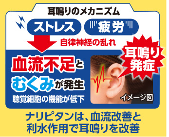 耳鳴りのメカニズム