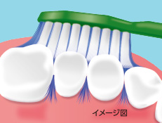 歯間に入って歯垢をかき取る