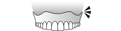 粘着力で、入れ歯をくっつけます