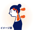 緊張型頭痛イメージ