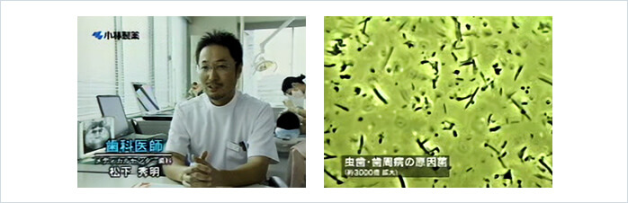 CMの変遷その2…特徴となった6本入りの誕生